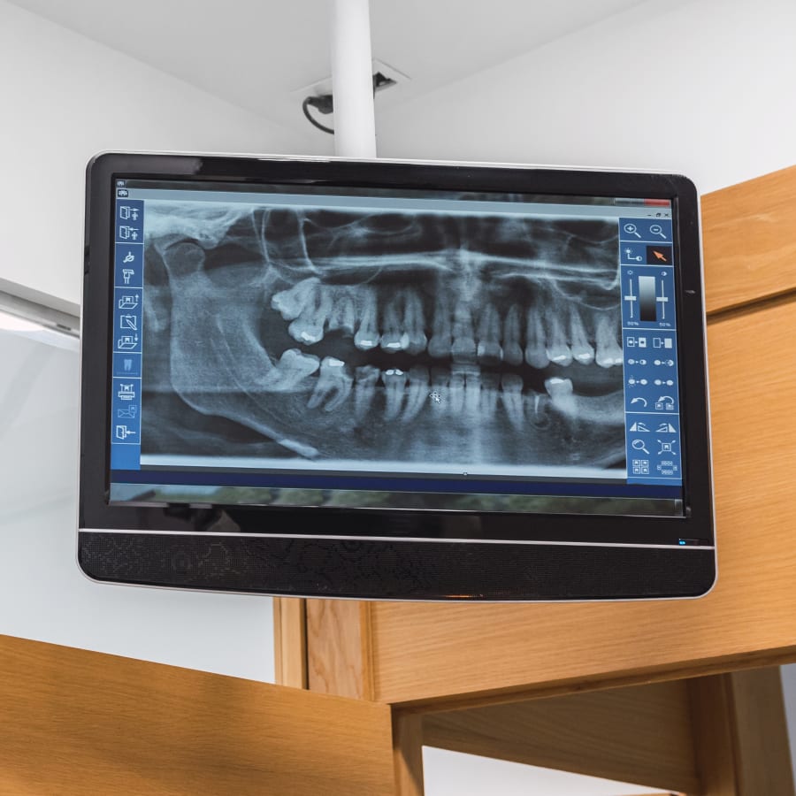 Dental Technology, Caledon East Dentist